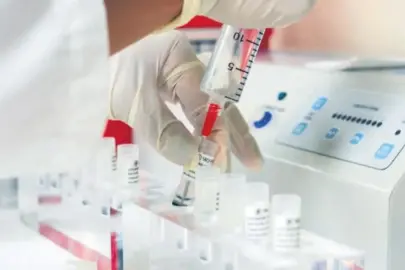 Kök hücre naklinde dünyada ilk 5’teyiz