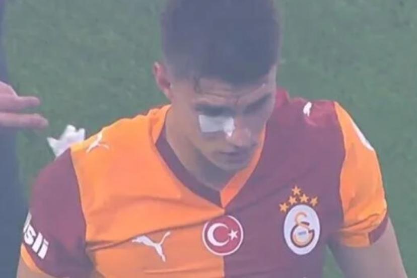 Kazımcan Karataş'a derbide yabancı madde geldi!