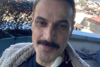 Ufuk Özkan taburcu oldu