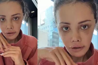 Yüz nakli yaptırmıştı! Didem Ceran kansere yakalandı