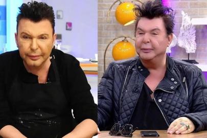 Estetik olmuştu! Kuşum Aydın'ın yüzünün son halini paylaştı