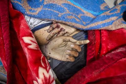 Katil İsrail'in Gazze'ye saldırılarında can kaybı 72 bin 280'e yükseldi