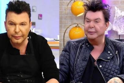 Yüzü deforme olmuştu! Kuşum Aydın ameliyat oldu