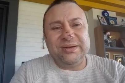 Pitbull saldırısında hastanelik olan Onur Akay o anları anlattı