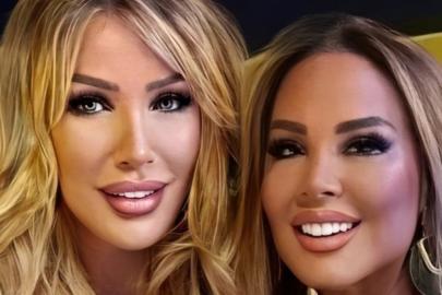 Safiye Soyman yine estetik yaptırdı! Yüzünü gerdirip gıdığını aldırdı