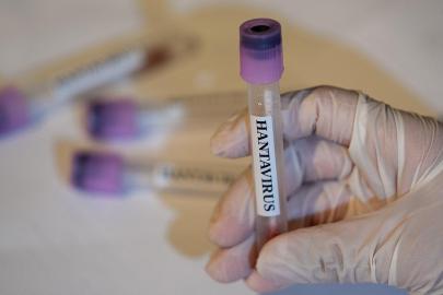 Kanada'da bir kişinin hantavirüs testi pozitif çıktı